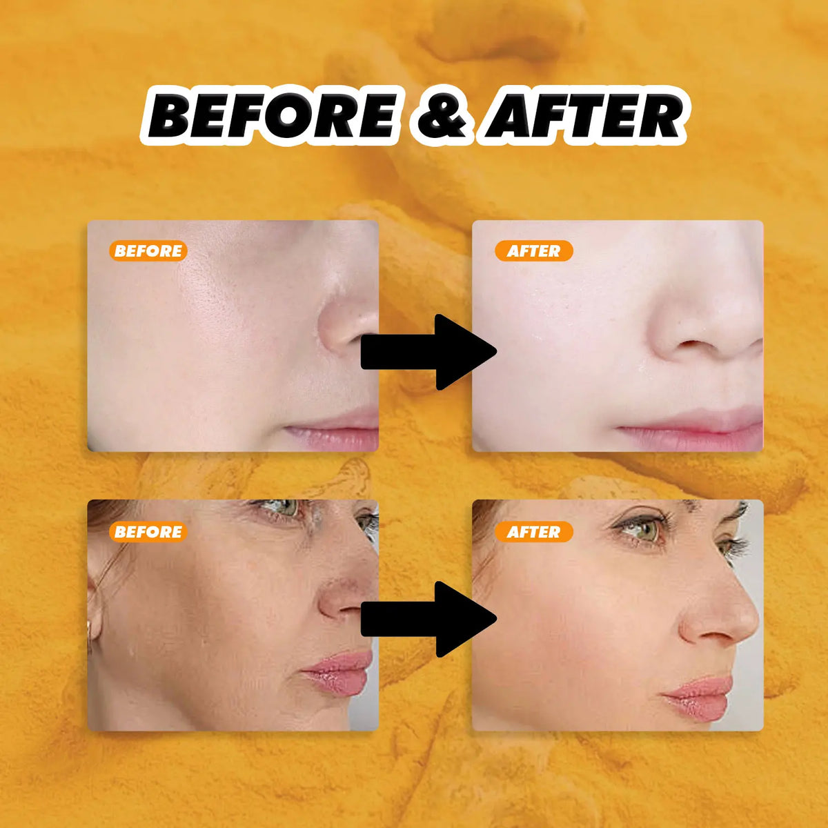 Turmeric & Honey Skincare Set, Face Oil + Moisturizing Cream, Deep Hydration & Nourishing Care for Soft Smooth Glowing Skin